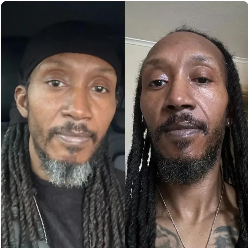 Cheveux d'homme avant / après