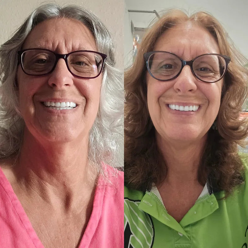 Comparaison avant / après avec lunettes